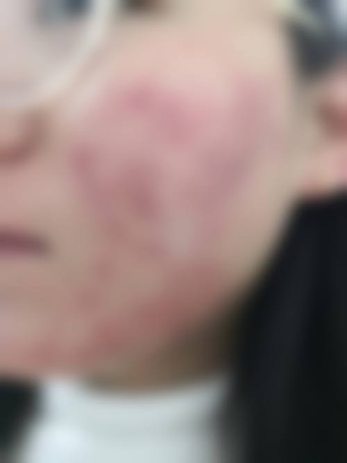 韩国beautyline整形医院怎么样之项目特色