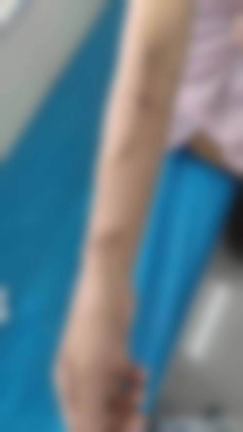 德州百媚医疗美容诊所更擅长什么手术