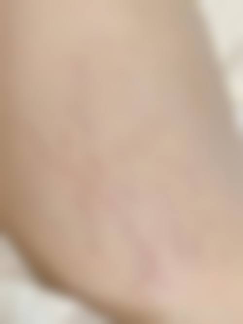 北京紫美韵整形医疗美容诊所更擅长什么