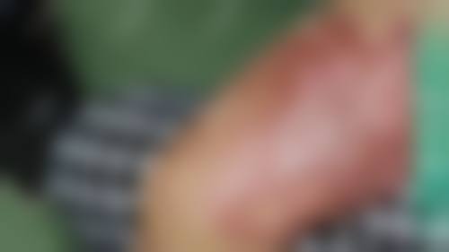 东莞韩美医疗美容整形医院怎么样之真实患者口碑评价