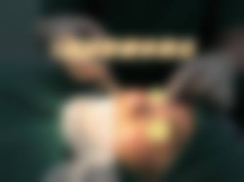 韩国beautyline整形医院怎么样，口碑评价如何？