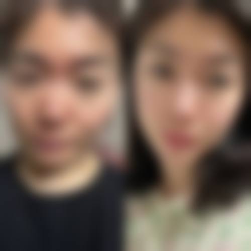 东莞韩美医疗美容整形医院怎么样之项目特色