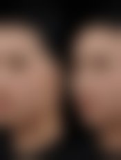 郑州聂丽丽医疗美容诊所更擅长什么手术