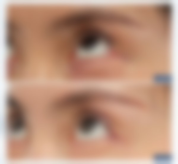 上海爱尚丽格医疗美容门诊部陈丽丹业内荣誉真实评价