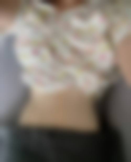 衡阳雅美整形医院怎么样：口碑好不好？附真实患者口碑评价