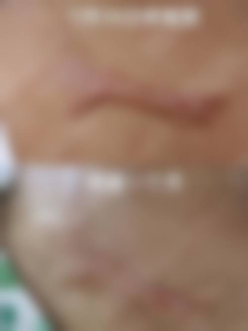 衡阳雅美整形医院怎么样：地址及乘车路线