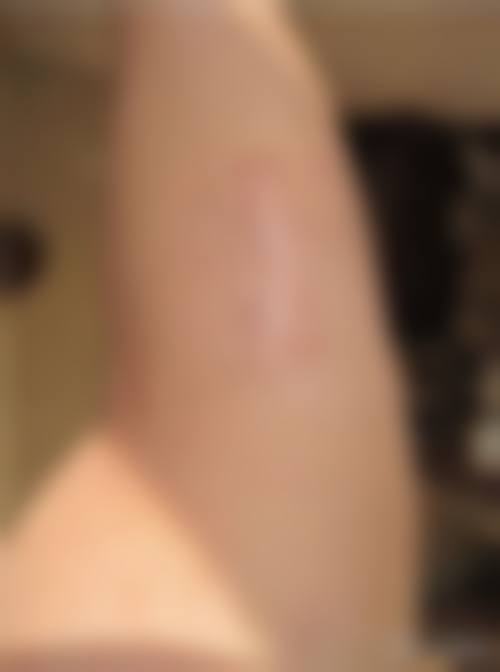 七、重庆爱丽美医疗美容门诊部顾客实例怎样