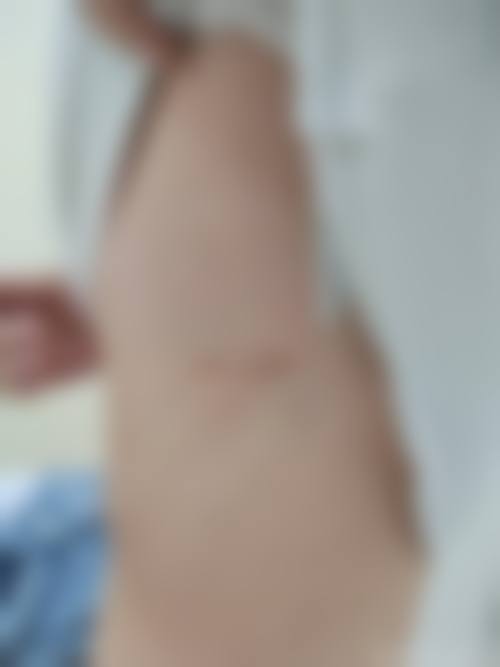 定西美颜滤镜主义整形医院口碑好不好?附真实患者口碑评价