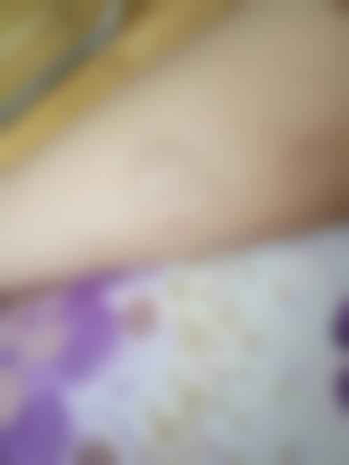 蚌埠市中医医院(针灸美容科)项目特色