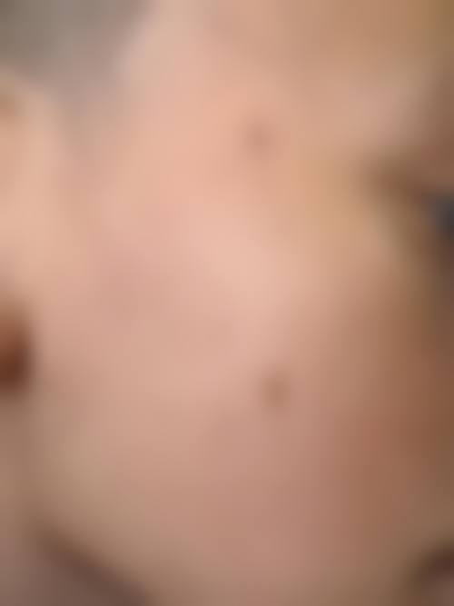 杭州悦可医疗美容诊所高寿松手术风格之价格透明定制