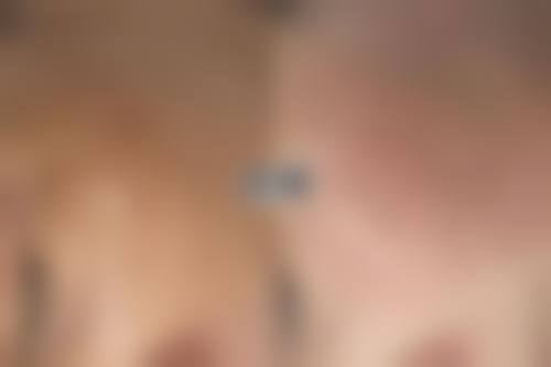 衡阳雅美整形医院怎么样：项目特色