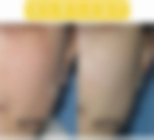 曾繁茂医生简介项目优势