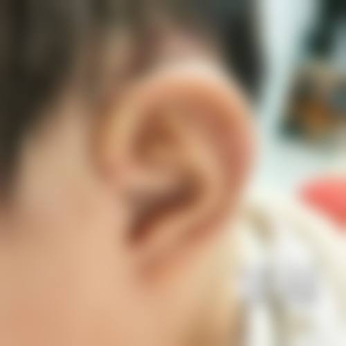 哈尔滨悠然医疗美容门诊部顾客实例