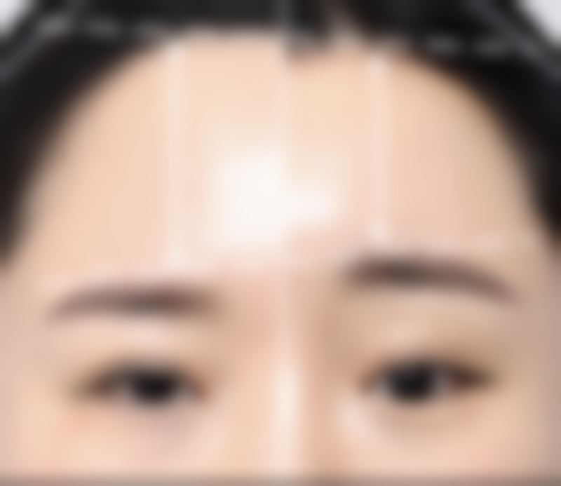 黑眼袋怎么产生的之眼部血循环不良:办公室综合征