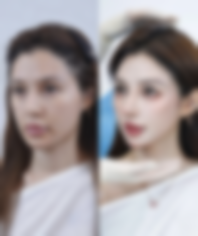 肚子吸脂风险大吗之判断风险的方法