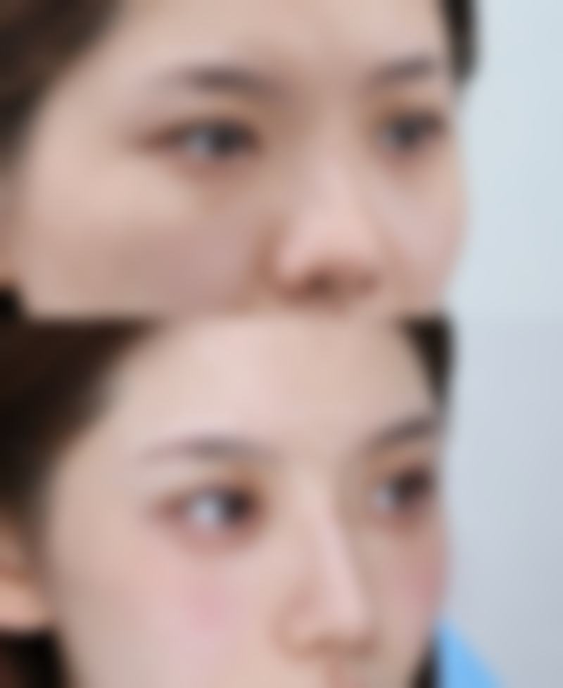 肚子吸脂风险大吗之医院和医生的影响