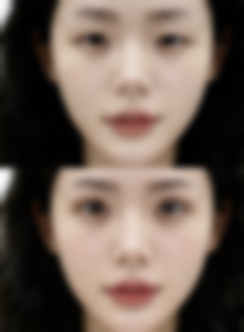 肚子吸脂风险大吗之部分人高风险原因