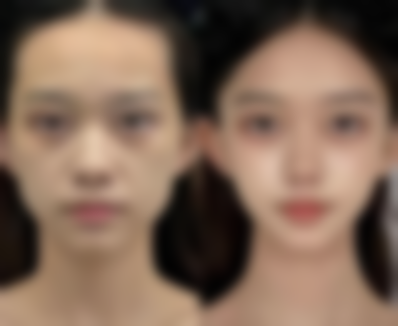 定西美颜滤镜主义整形医院价格表