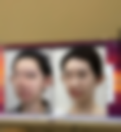 黑眼袋怎么产生的之睡眠不足:熬夜党的“勋章”