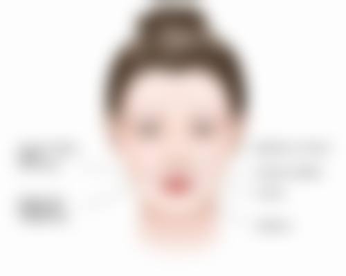 天生的黑眼袋怎么消除？医美激光+天然眼霜双管齐下，按摩手法和维生素C饮食双助攻