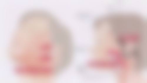 小腿抽脂成效反弹：医院术后建议与患者生活方式的调整