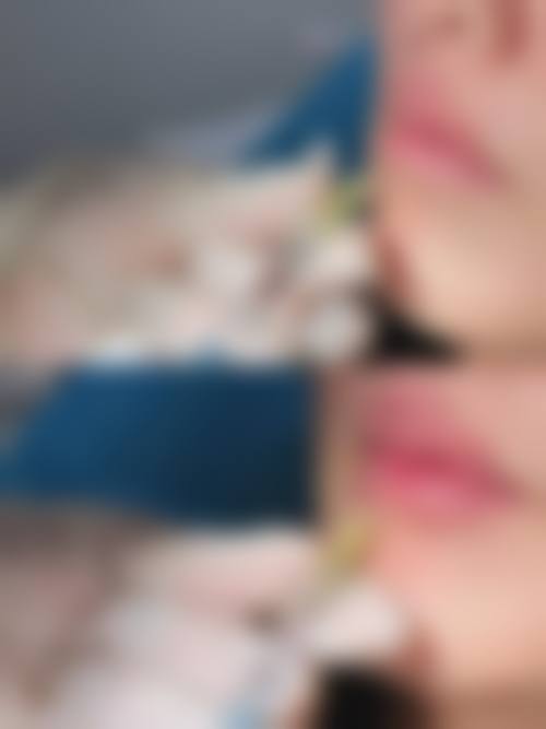 三、北京A＋整形医院怎么样，口碑评价如何？