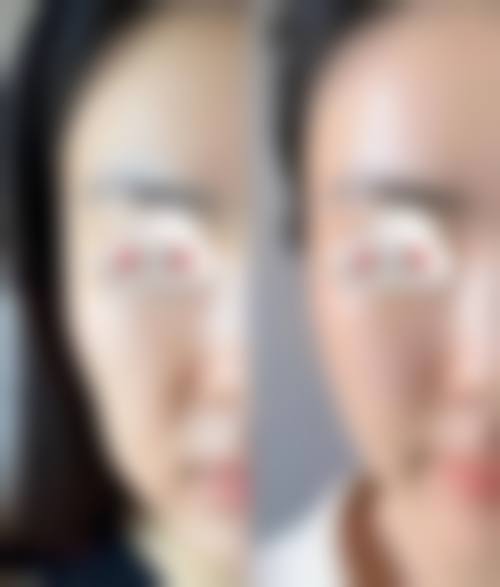 王小曼医生顾客实例图片