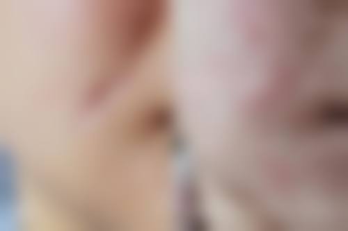 湘潭顾维新医疗美容科诊所更擅长什么手术