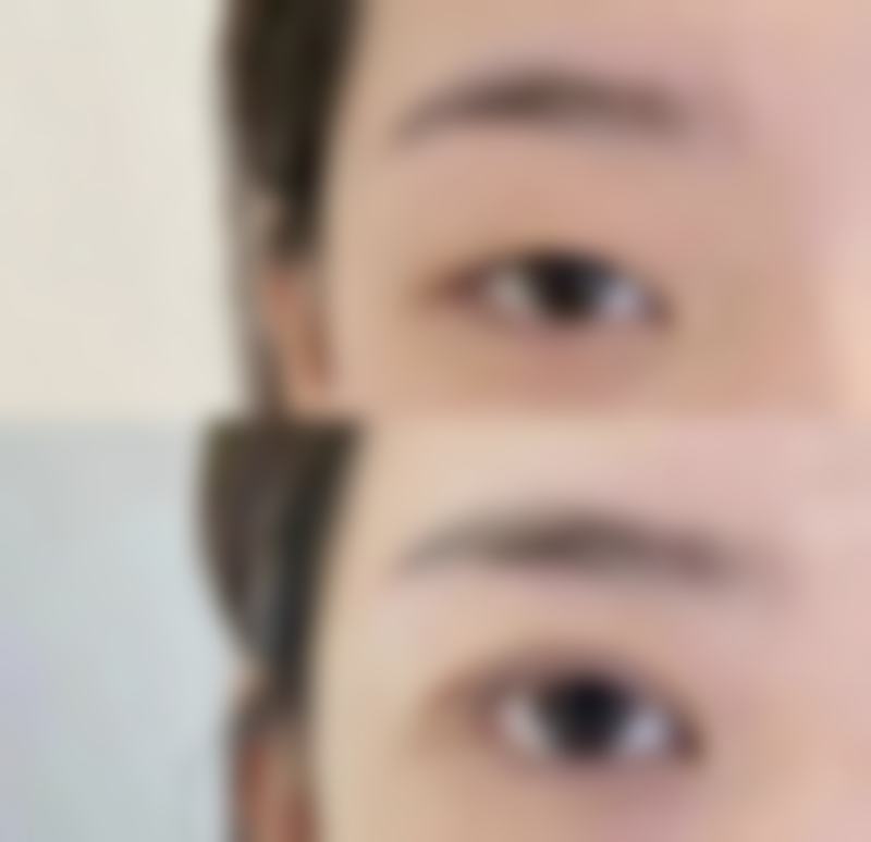 韩国江南延世整形外科是否正规