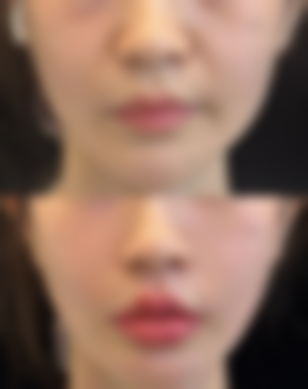 韩国卓凯(KAI)整形医院口碑评价如何