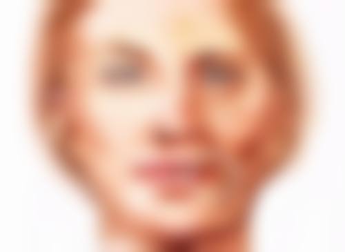 重获自信明眸：割过的双眼皮疤痕修复的希望