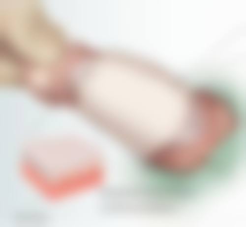 皮肤疤痕体质怎么治疗——饮食调理:广州南粤医院骨干医生推荐吃出健康皮肤