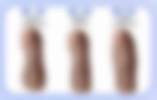 皮肤疤痕体质怎么治疗？激光联合中医调理，告别增生烦恼