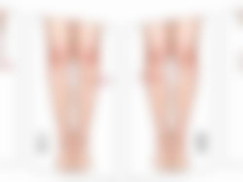 割过的双眼皮有疤痕可以修复吗？专业整形医院激光祛疤+精细缝合重塑自然双眼皮