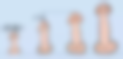 慧眼识珠：如何选择靠谱的割过的双眼皮疤痕修复医院