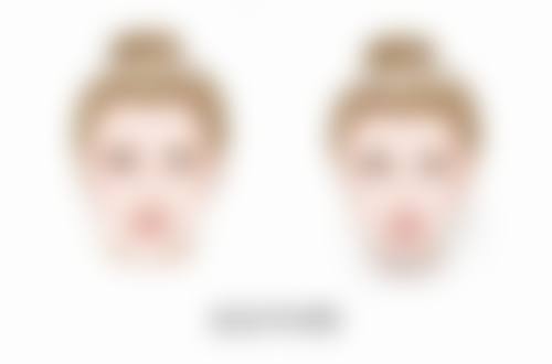 埋线双眼皮能管多少年之常见误区揭秘