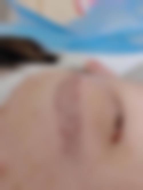 詹慧医生怎么样