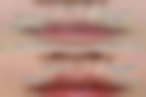 肚子大抽脂会反弹吗？三甲医生揭秘抽脂量+术后运动关键点