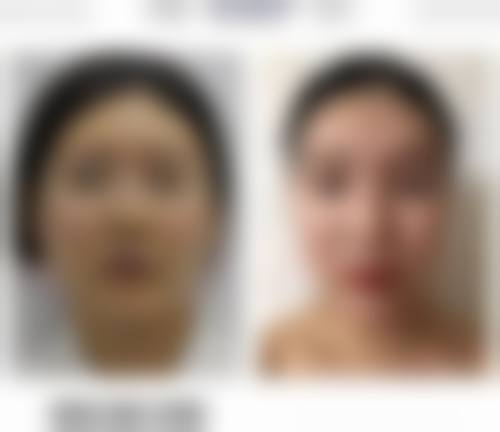 疤痕体质能怀孕，分娩方式怎么选