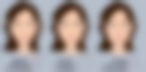 宝宝脸上的冻疮疤痕怎么去除——3种安心有效的祛疤药物推荐