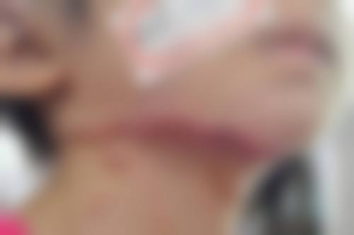 通辽德尔美客整形医院口碑评价