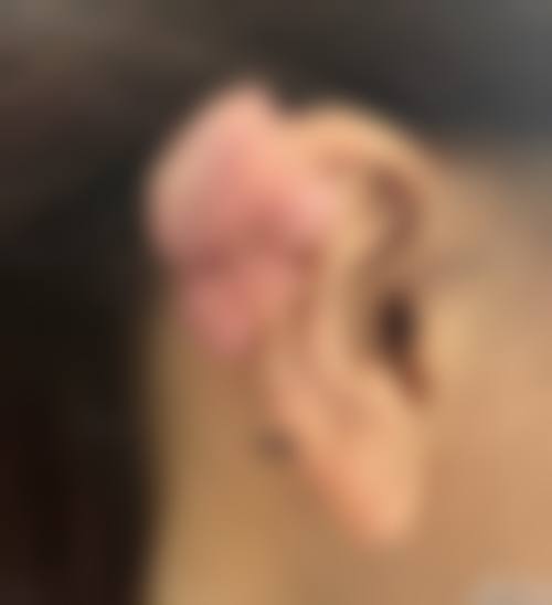 通辽德尔美客整形医院价格表