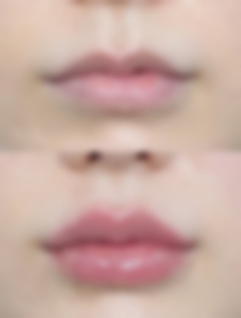 宝宝脸上的冻疮疤痕怎么去除——何时需要寻求专精帮助