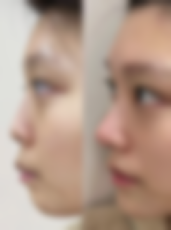 疤痕体质能怀孕，三大风险需预警