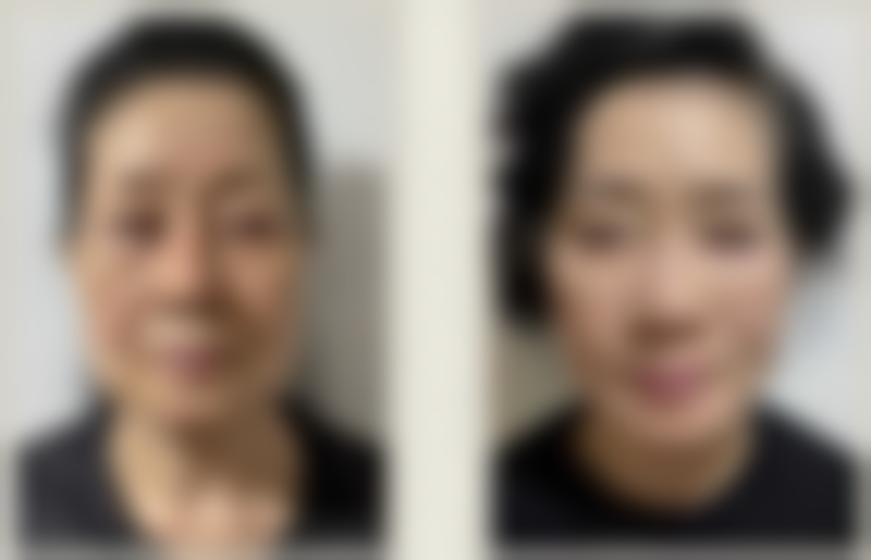 成都议月医疗美容诊所怎么样，价格表