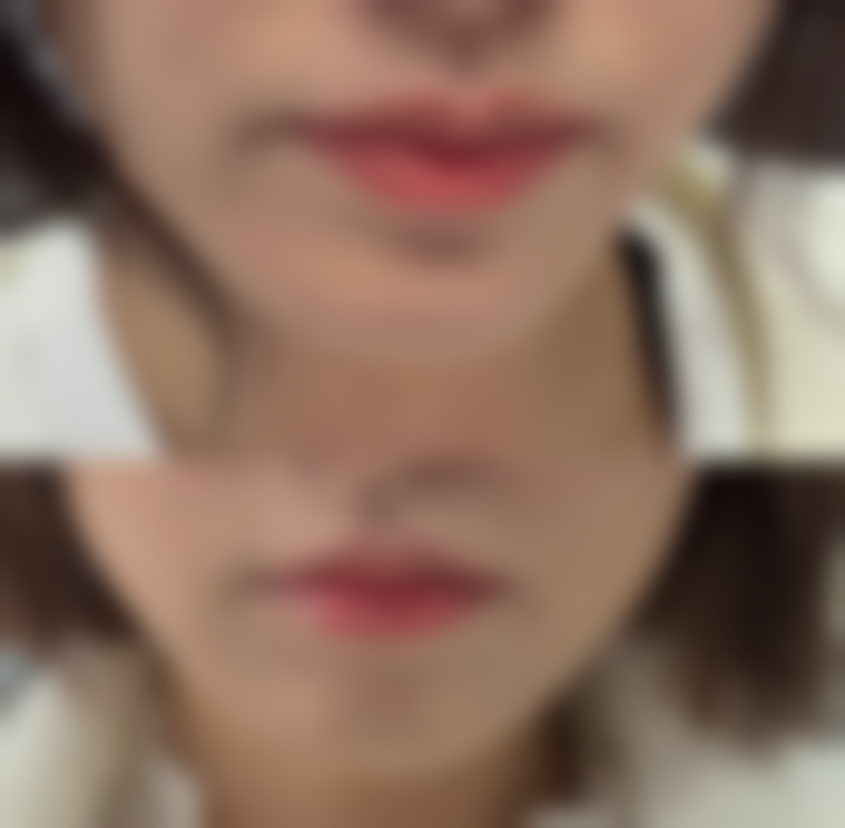 石家庄艾麦德医疗美容整形医院价格表