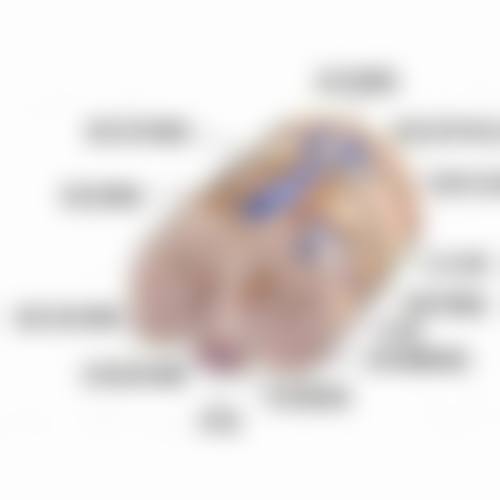 吸脂后14天:开启射频治疗的黄金起点