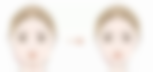 写在末尾：美丽是一场持久战