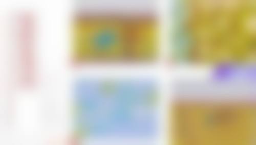 自体脂肪填充眼袋保持时间与医生技术的联系