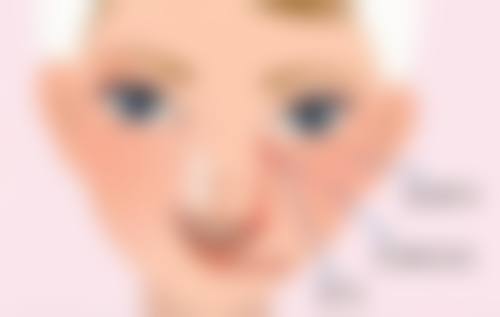 自体脂肪填充眼袋成效持久的医院选择秘籍